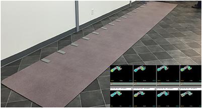 Functional Ambulation Profile (FAP) Score as a Potential Marker of Gait Analysis in Myotonic Dystrophy Type 1